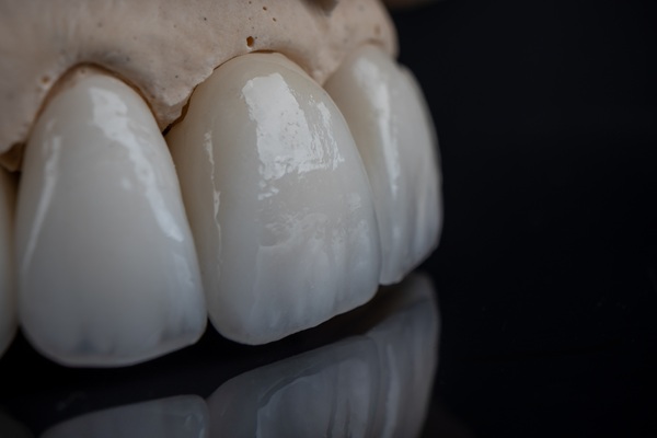 Common Issues With Dental Crowns And How To Fix Them