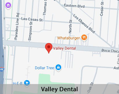 Map image for When Is a Tooth Extraction Necessary in Brownsville, TX